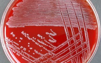 Enterococcus faecalis Blood Agar 48h culture incubated with O2