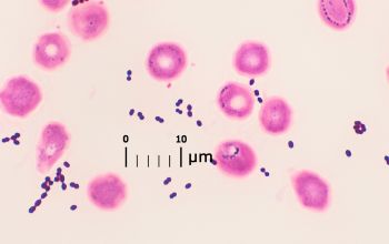 Enterococcus faecium Gram stain