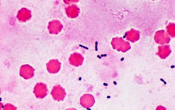 Enterococcus faecium Gram stain