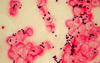 Enterococcus gallinarum Gram stain