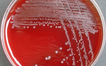 Enterococcus gallinarum Blood Agar 48h culture incubated with O2