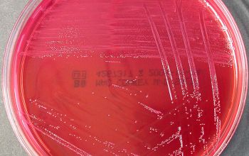 Enterococcus gallinarum Mac Conkey Agar without salt 24h culture incubated with CO2