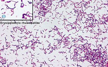 Erysipelothrix rhusiopathiae Gram stain