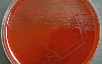 Erysipelothrix rhusiopathiae Blood Agar 24h culture incubated with CO2