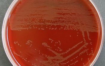 Erysipelothrix rhusiopathiae Blood Agar 48h culture incubated with O2