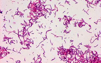 Erysipelothrix rhusiopathiae Gram stain