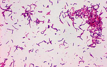 Erysipelothrix rhusiopathiae Gram stain