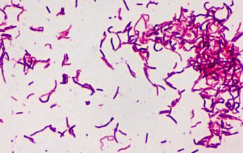 Erysipelothrix rhusiopathiae Gram stain