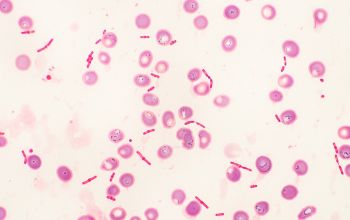 Escherichia coli Gram stain