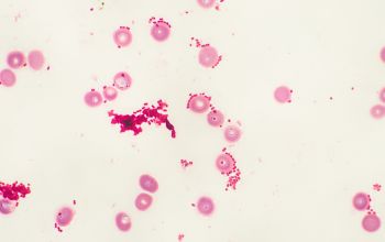 Escherichia coli Gram stain