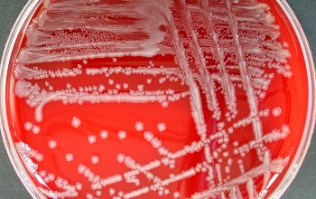 Escherichia coli Blood Agar 24h culture incubated with O2