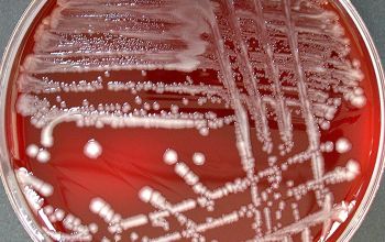 Escherichia coli Blood Agar 48h culture incubated with O2