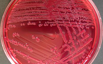 Escherichia coli Mac Conkey Agar without salt 24h culture incubated with O2