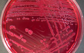 Escherichia coli Mac Conkey Agar without salt 48h culture incubated with O2