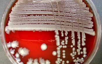 Escherichia coli Blood Agar 48h culture incubated with O2