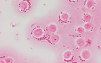 Escherichia coli Gram stain