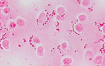 Escherichia coli Gram stain