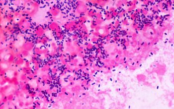 Escherichia coli Gram stain