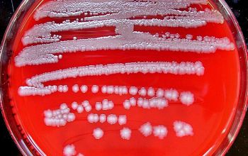Escherichia coli Blood Agar 24h culture 