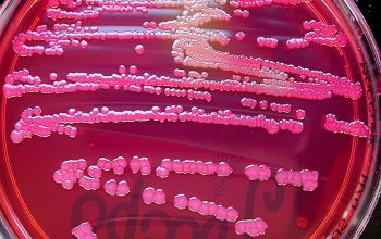 Escherichia coli Mac Conkey Agar without salt 24h culture 