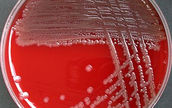 Escherichia hermannii (Atlantibacter hermannii) Blood Agar 24h culture incubated with CO2