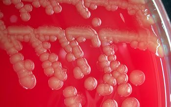 Escherichia hermannii (Atlantibacter hermannii) Blood Agar 24h culture incubated with CO2