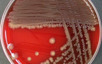 Escherichia hermannii Blood Agar 48h culture incubated with O2