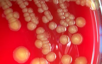 Escherichia hermannii Blood Agar 48h culture incubated with O2