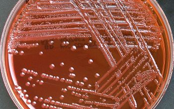 Escherichia hermannii (Atlantibacter hermannii) Mac Conkey Agar without salt 24h culture incubated with O2
