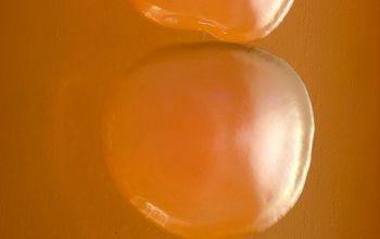 Escherichia hermannii (Atlantibacter hermannii) Blood Agar 24h culture incubated with O2