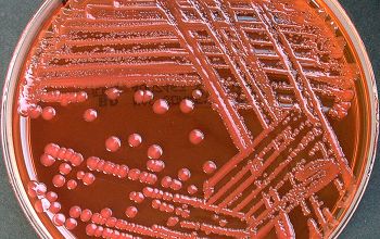 Escherichia hermannii (Atlantibacter hermannii) Mac Conkey Agar without salt 48h culture incubated with O2