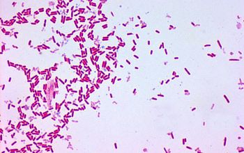 Escherichia hermannii (Atlantibacter hermannii) Gram stain