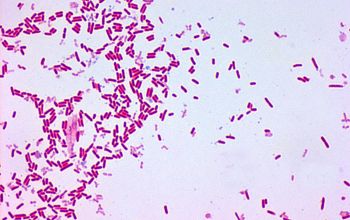 Escherichia hermannii Gram stain