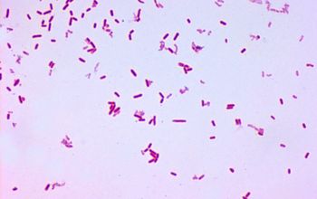 Escherichia hermannii Gram stain