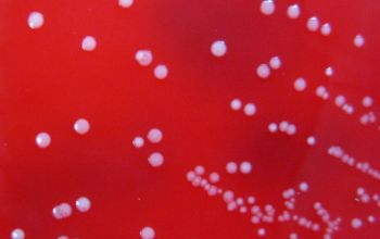 Finegoldia magna Brucella Blood Agar 48h culture 