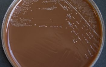 Francisella philomiragia Chocolate Agar 24h culture incubated with CO2