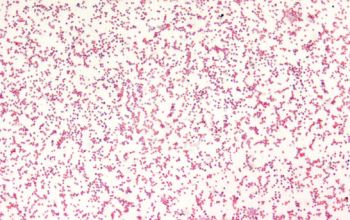 Francisella tularensis Gram stain