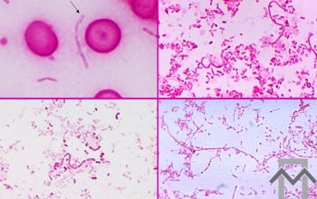 Fusobacterium necrophorum Gram stain