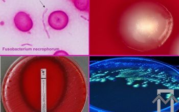 Fusobacterium necrophorum  culture 