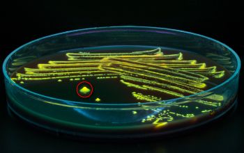 Fusobacterium necrophorum  culture 