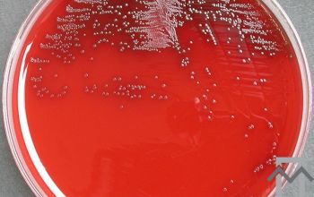 Fusobacterium necrophorum Brucella Blood Agar 48h culture anaerobicly incubated