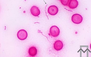 Fusobacterium necrophorum Gram stain