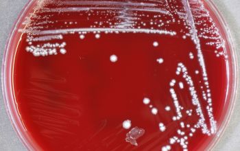 Fusobacterium nucleatum Brucella Blood Agar 48h culture anaerobicly incubated