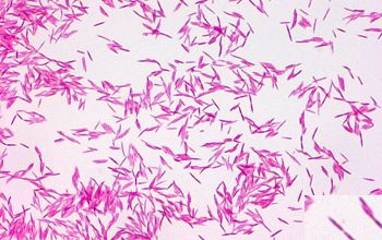 Fusobacterium nucleatum Gram stain