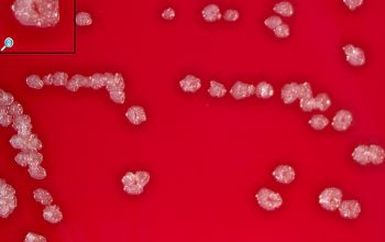 Fusobacterium nucleatum Brucella Blood Agar 48h culture anaerobicly incubated
