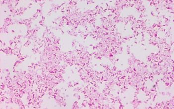 Fusobacterium varium Gram stain