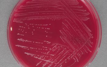 Gardnerella vaginalis Brucella Blood Agar 48h culture anaerobicly incubated