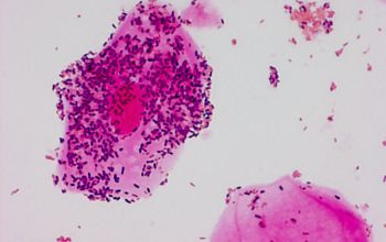 Gardnerella vaginalis Gram stain