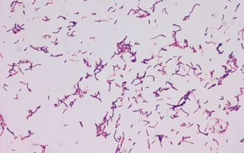 Gardnerella vaginalis Gram stain