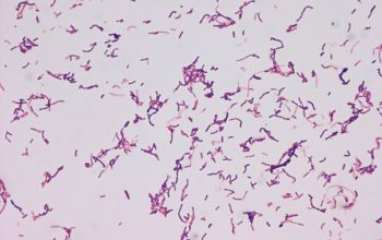 Gardnerella vaginalis Gram stain